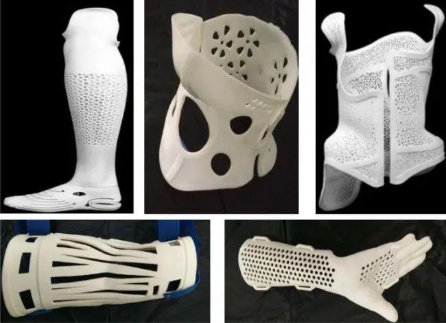 粥多僧少?3d打印康复矫形器赛道的新机遇|3d打印|假肢|辅具|侧弯_网易